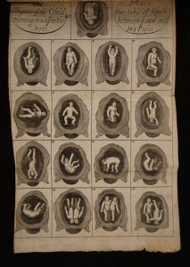 This is an image from James Cooke, Mellificium chirurgiae, containing drawing of different fetuses in utero. 